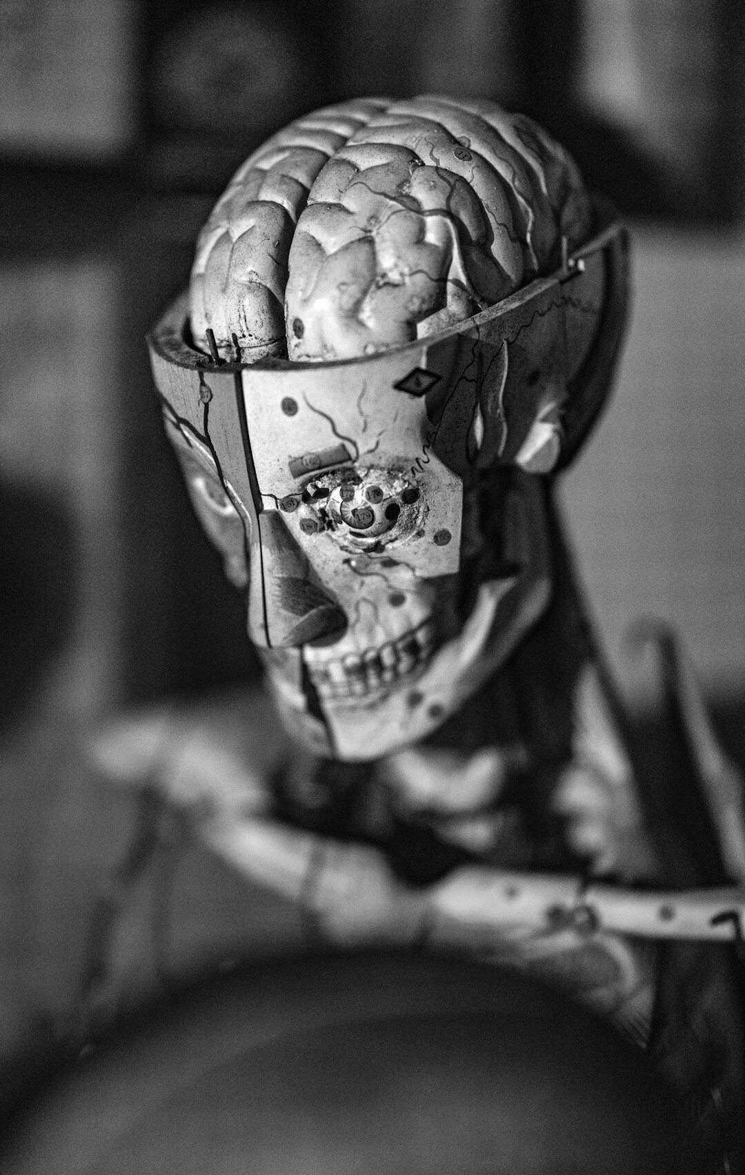 brain scan mri